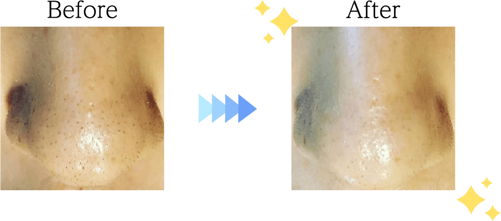 スキンケアフェイシャルBefore＆After