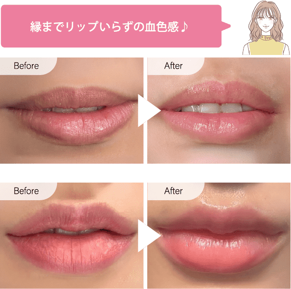 唇症例写真